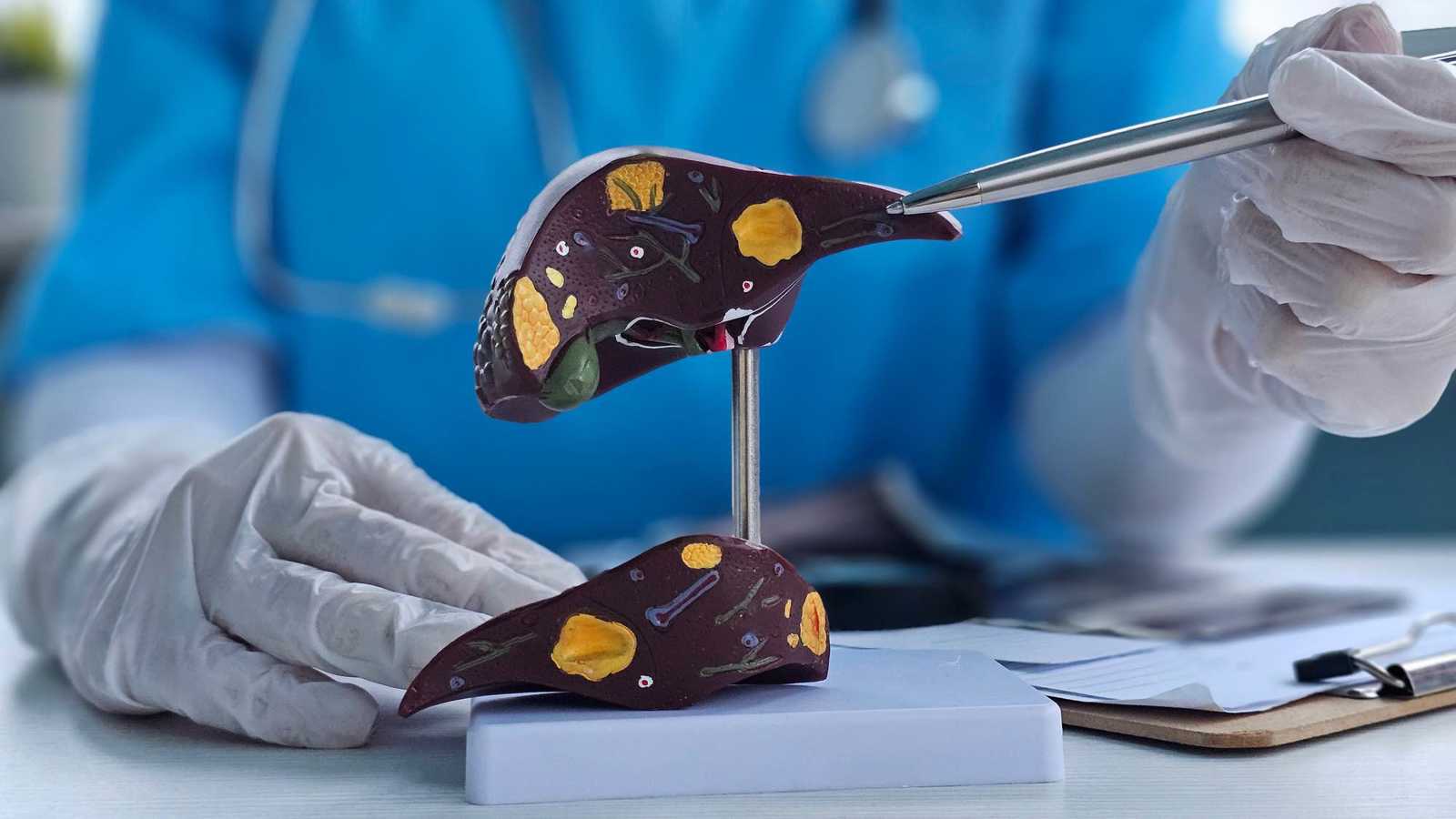 اختبار دم جديد يتنبأ بتلف الكبد قبل ظهور الأعراض