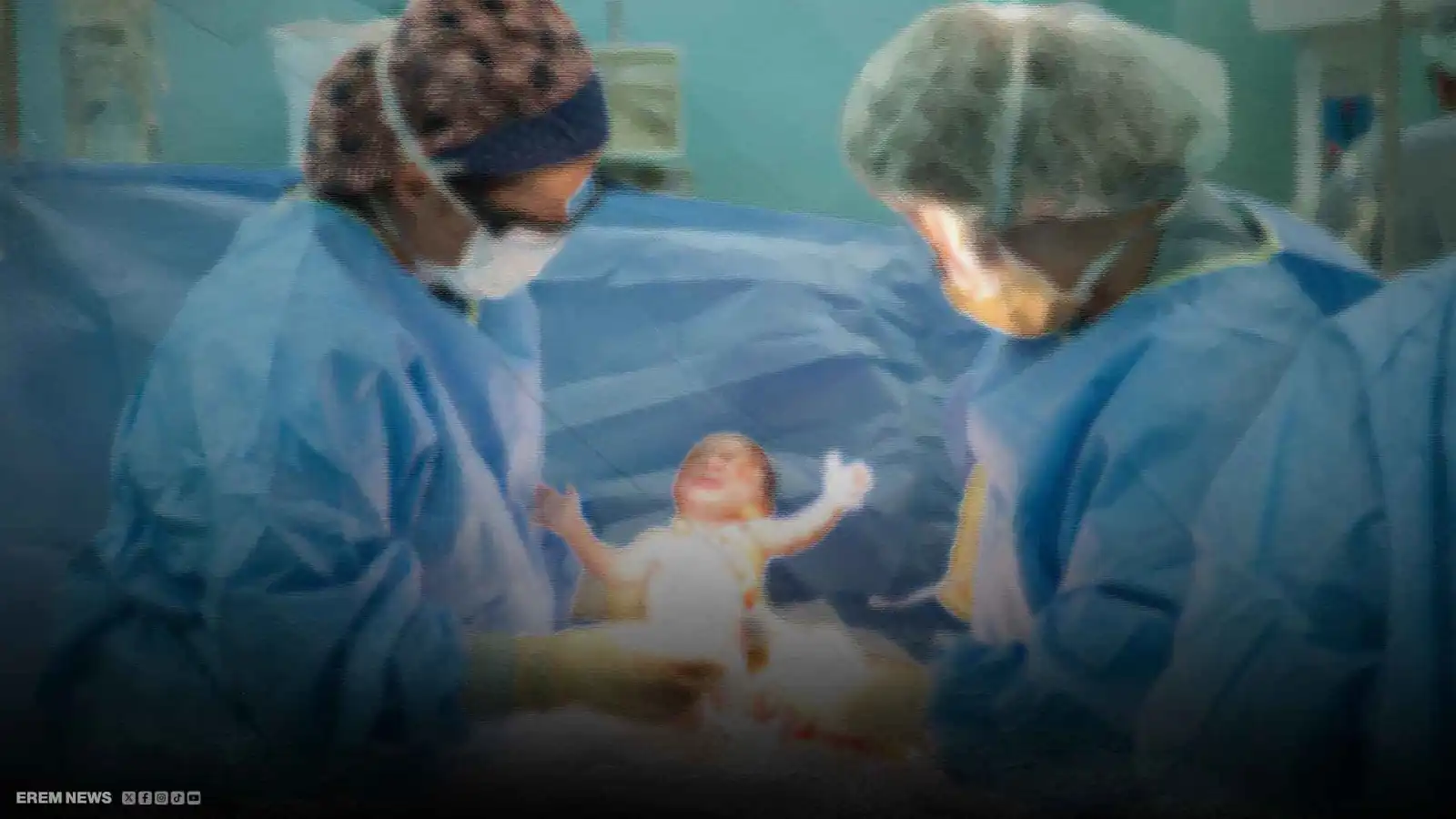 مصر تسجل رقماً "مرعباً" في عمليات الولادة القيصرية (فيديو إرم)