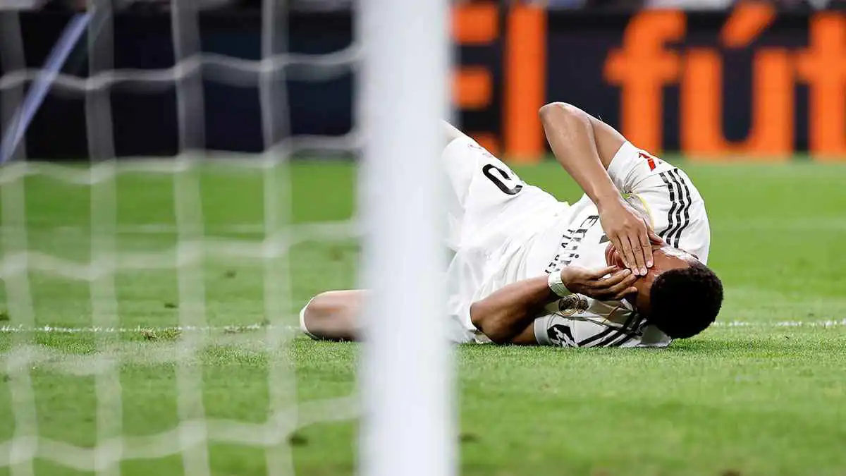 مبابي يكشف عن حجم إصابته في الوجه (صورة)