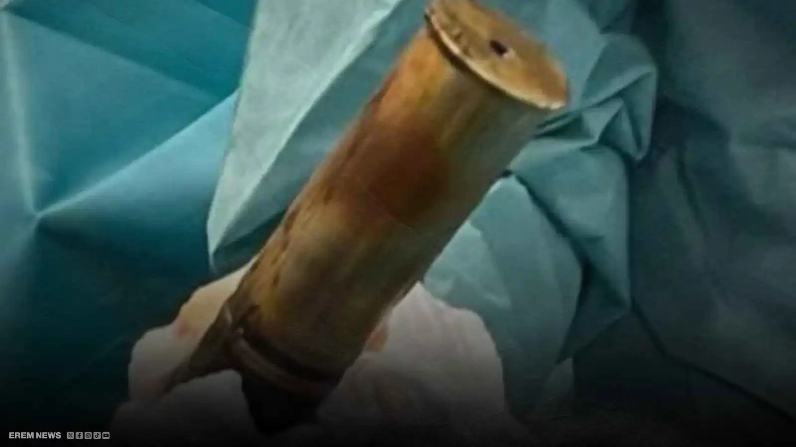 إخلاء مستشفى في فرنسا بعد العثور على قذيفة داخل جسد شاب (فيديو إرم)