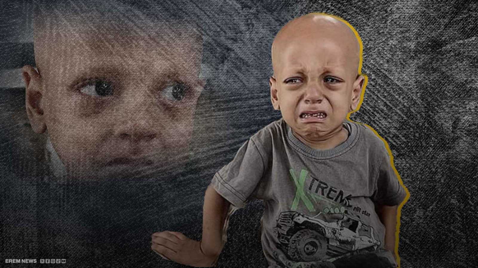 "أنا جعان".. وفاة الطفل الفلسطيني عبد الله أبو زرقة صاحب الصرخة التي هزت القلوب