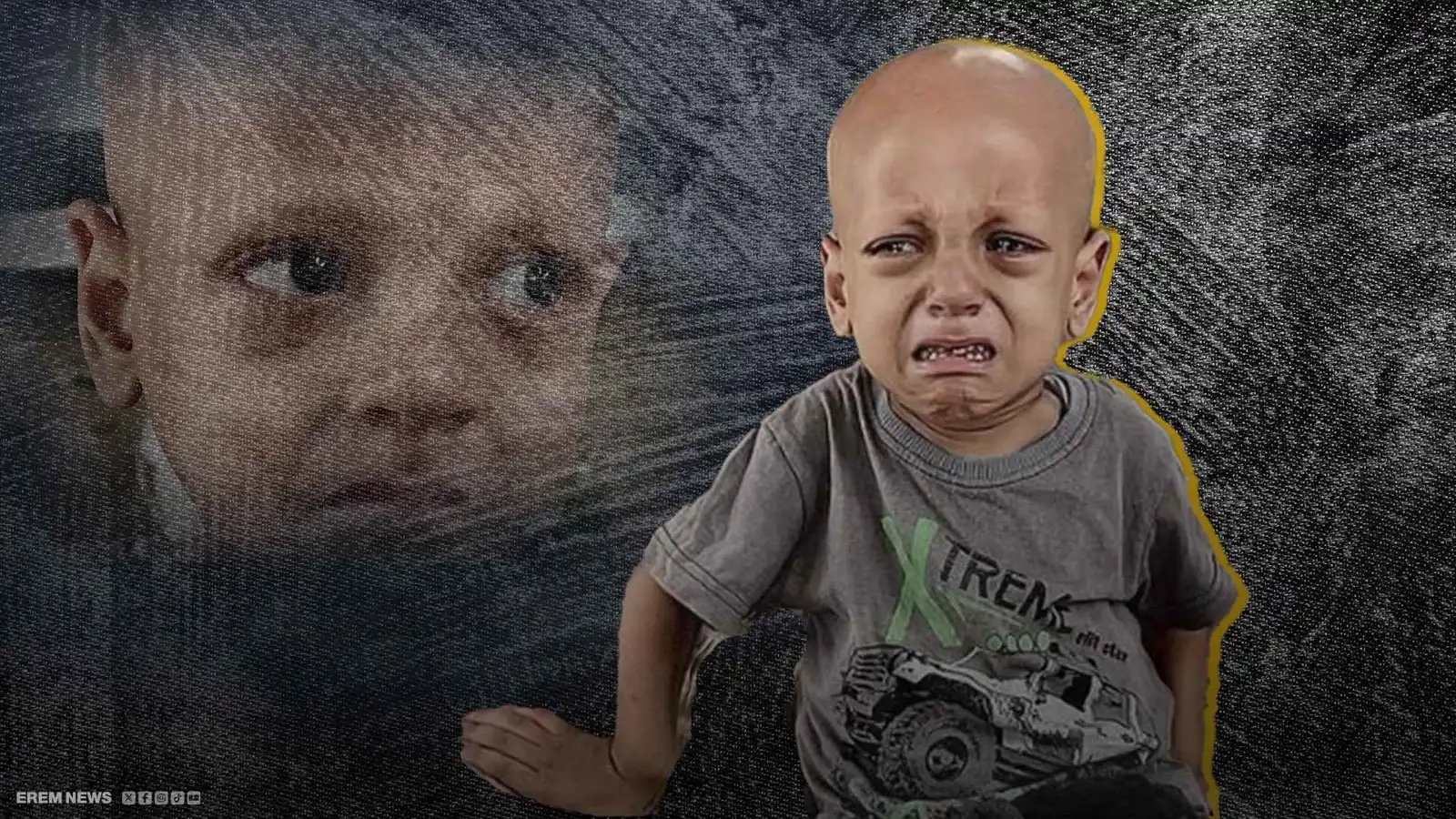 "أنا جعان".. وفاة الطفل الفلسطيني عبد الله أبو زرقة صاحب الصرخة التي هزت القلوب