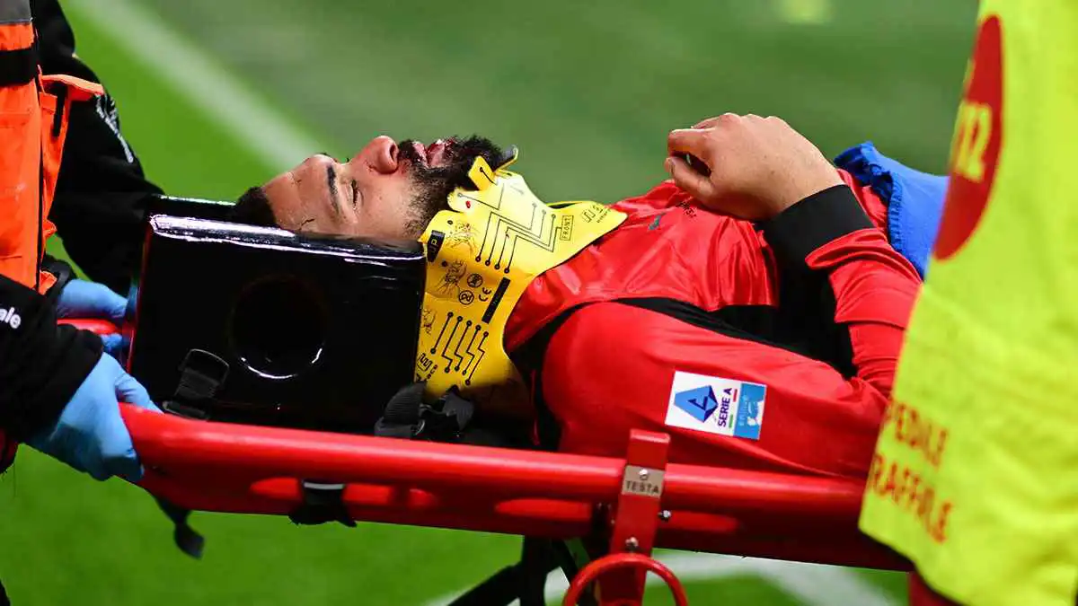 تطورات حالة نجم ميلان بعد تعرضه لكسر في الفك (فيديو)