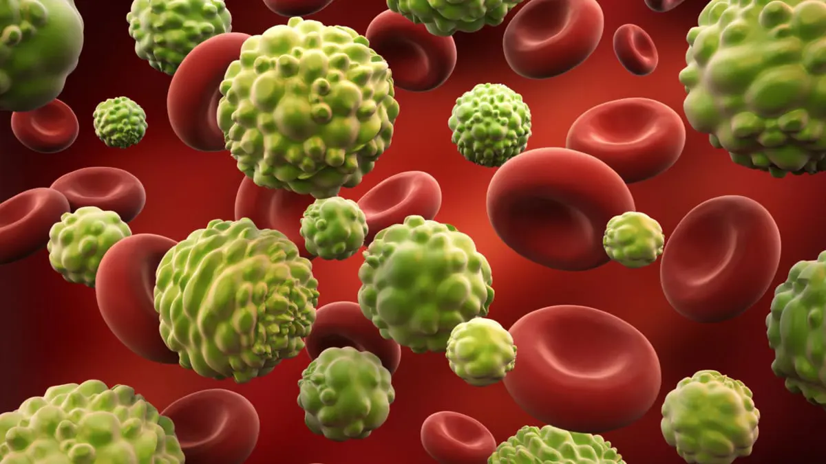 تطوير تقنية التصوير ثلاثي الأبعاد للكشف عن خلايا سرطانية بدلًا من الخزعات