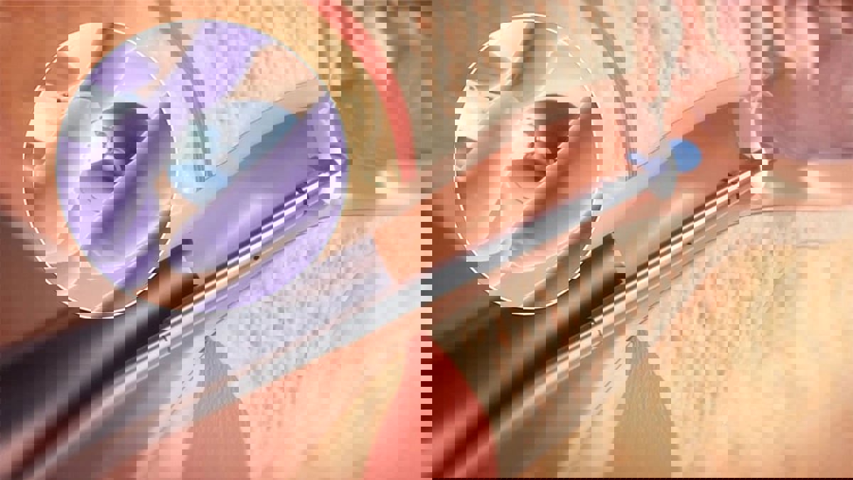 تقنية جديدة لإجراء عملية أنبوب الأذن للأطفال بعيدًا عن غرف العمليات