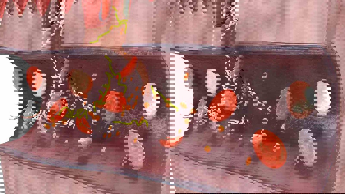 تقنية للتخلص من جلطات الدم بسرعة غير مسبوقة