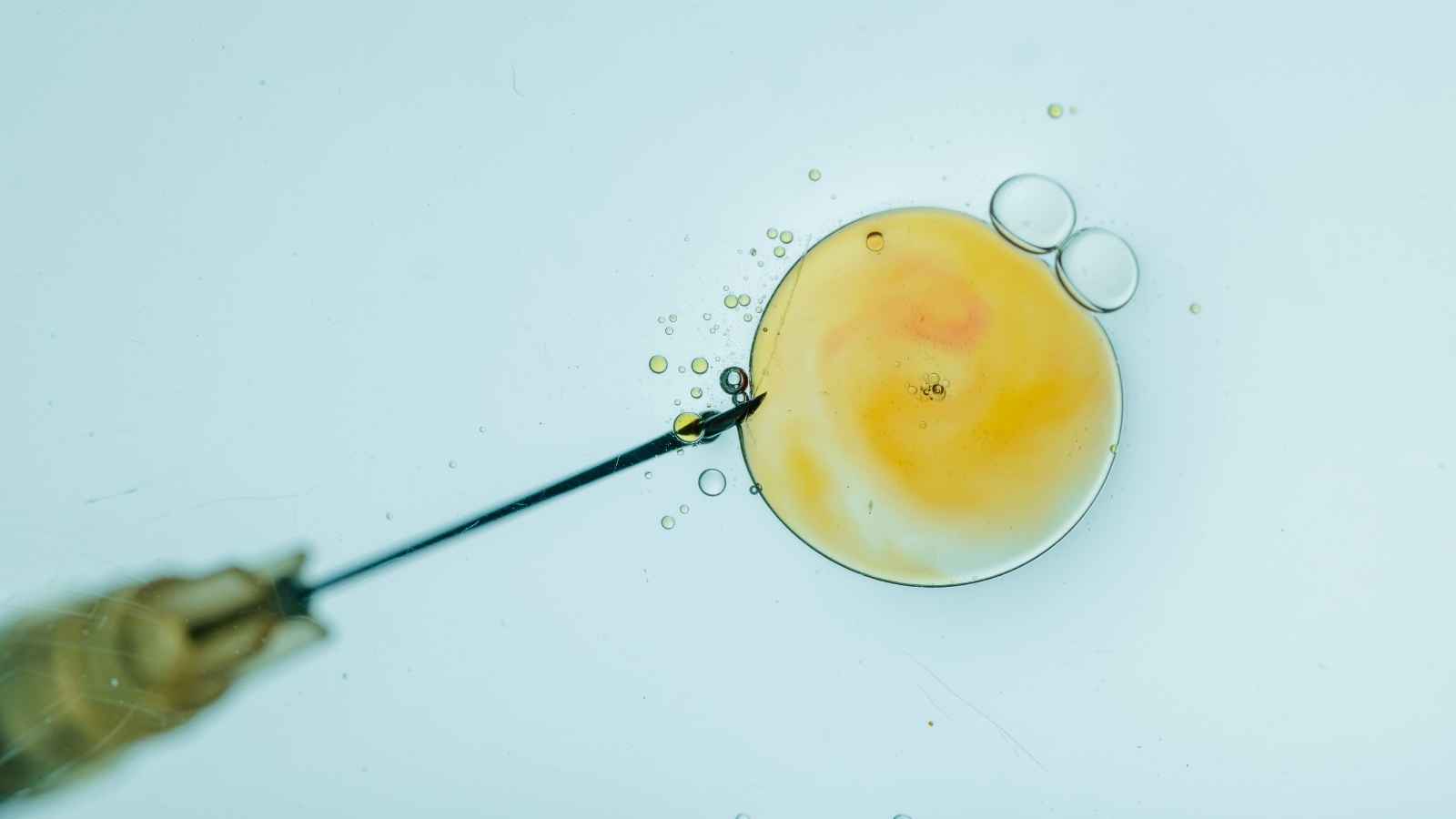 مركز طبي يشتري بويضات النساء الفقيرات مقابل شرط "غريب"