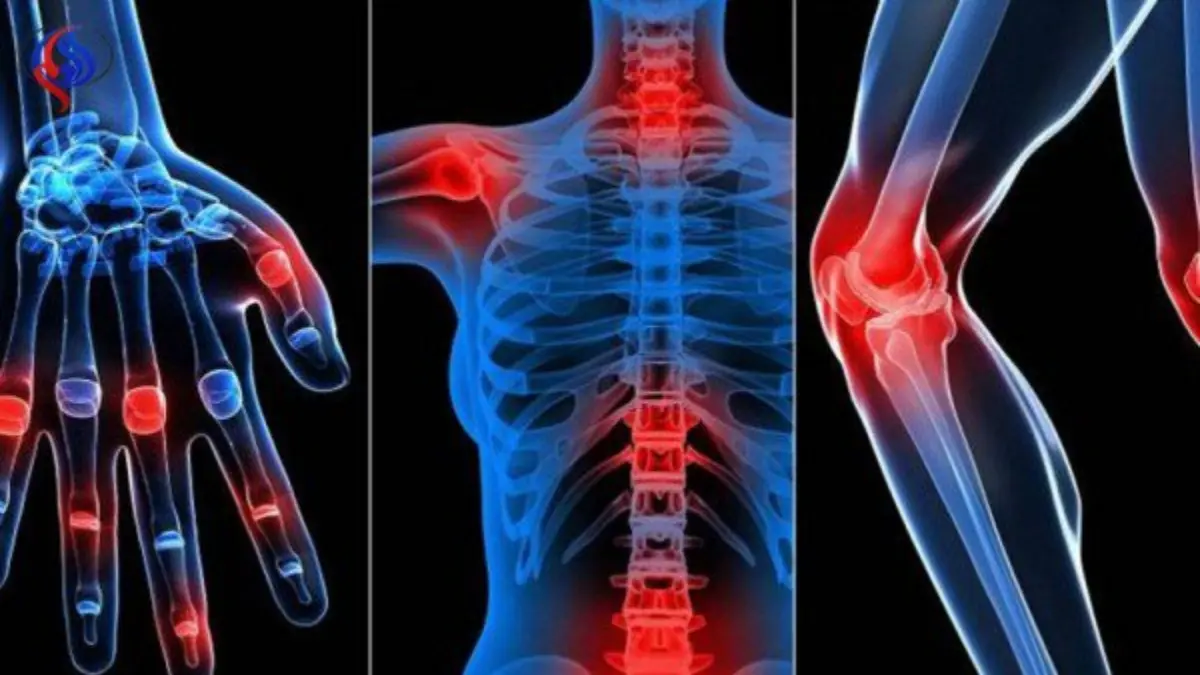 بينها القهوة وعصير الطماطم.. 9 مشروبات تسبب آلام المفاصل عليك تجنبها