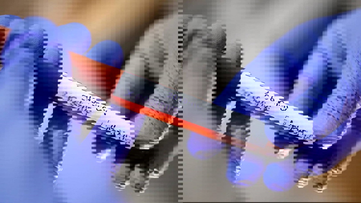 أول مسؤول يمني مصاب بكورونا يروي معاناته مع الفيروس (فيديو)