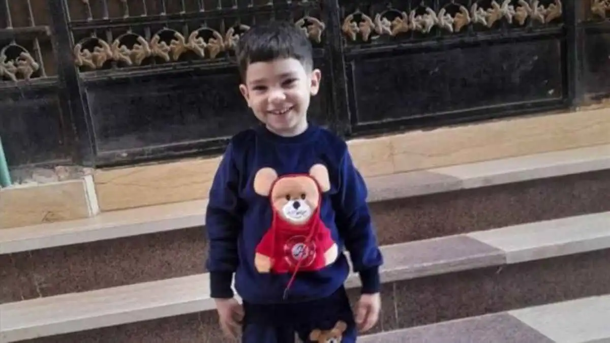 معجزة في غرفة العمليات.. إنقاذ ساق "طفل باسوس" بعد 12 ساعة جراحة