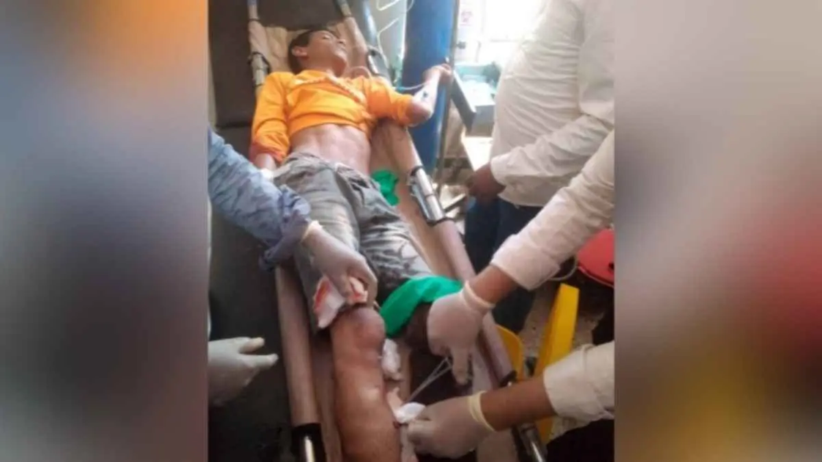 اليمن.. قناص حوثي يستهدف طفلا في تعز