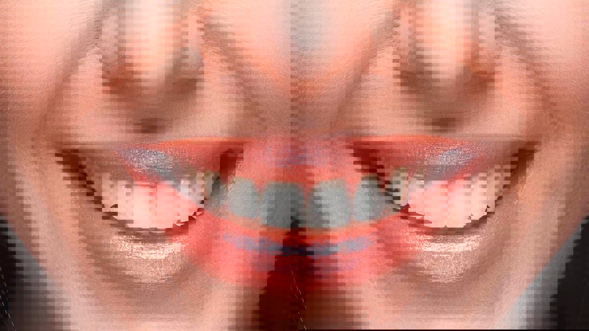 تطوير مستشعر من الألياف الكربونية لقراءة الشفاه