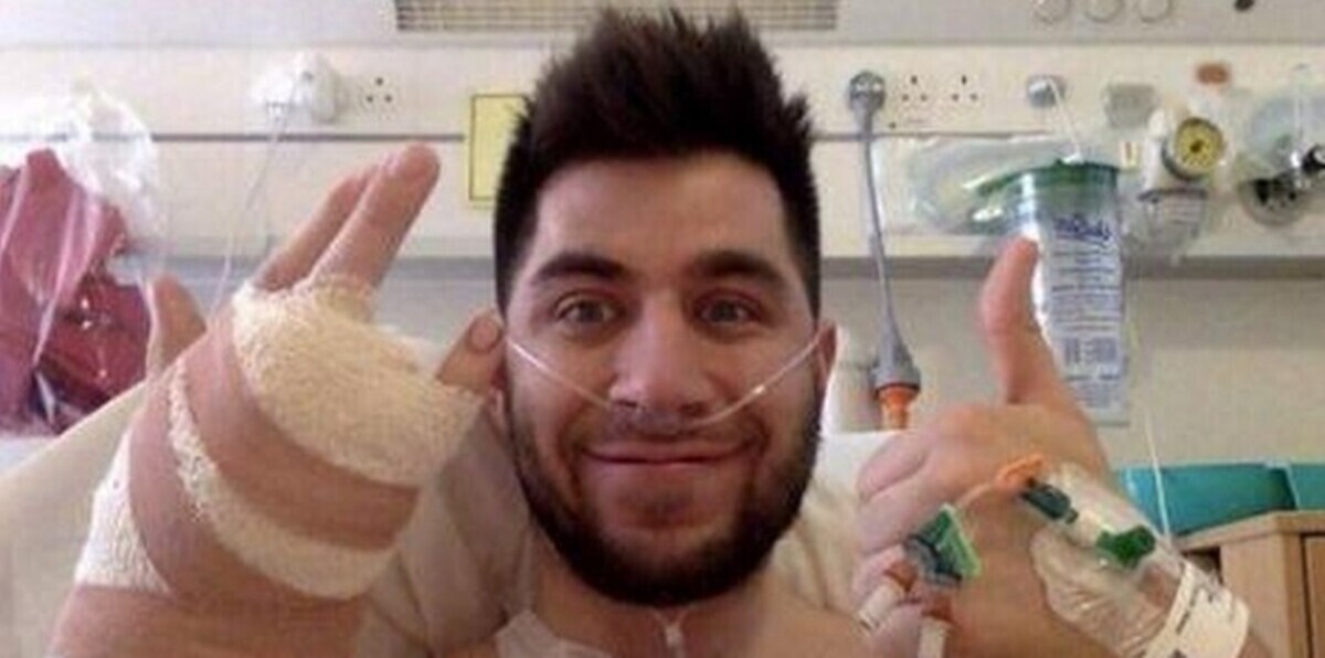 فقد إصبعه نتيجة حماسه وحبه لزوجته (صور)