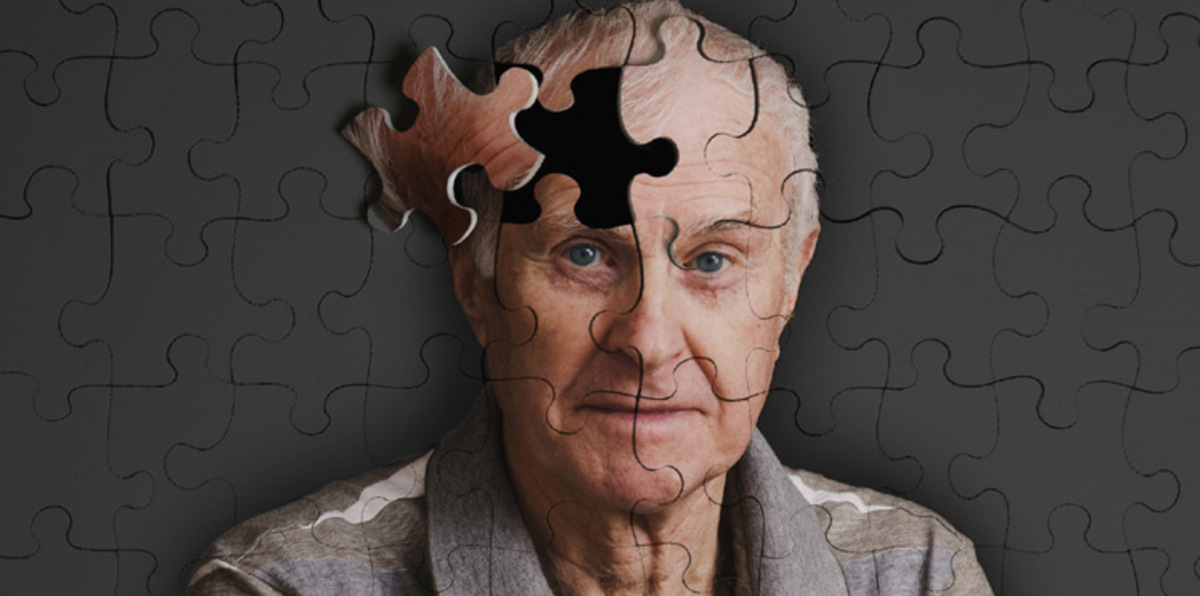 نقص الوزن يزيد خطر الإصابة بالزهايمر