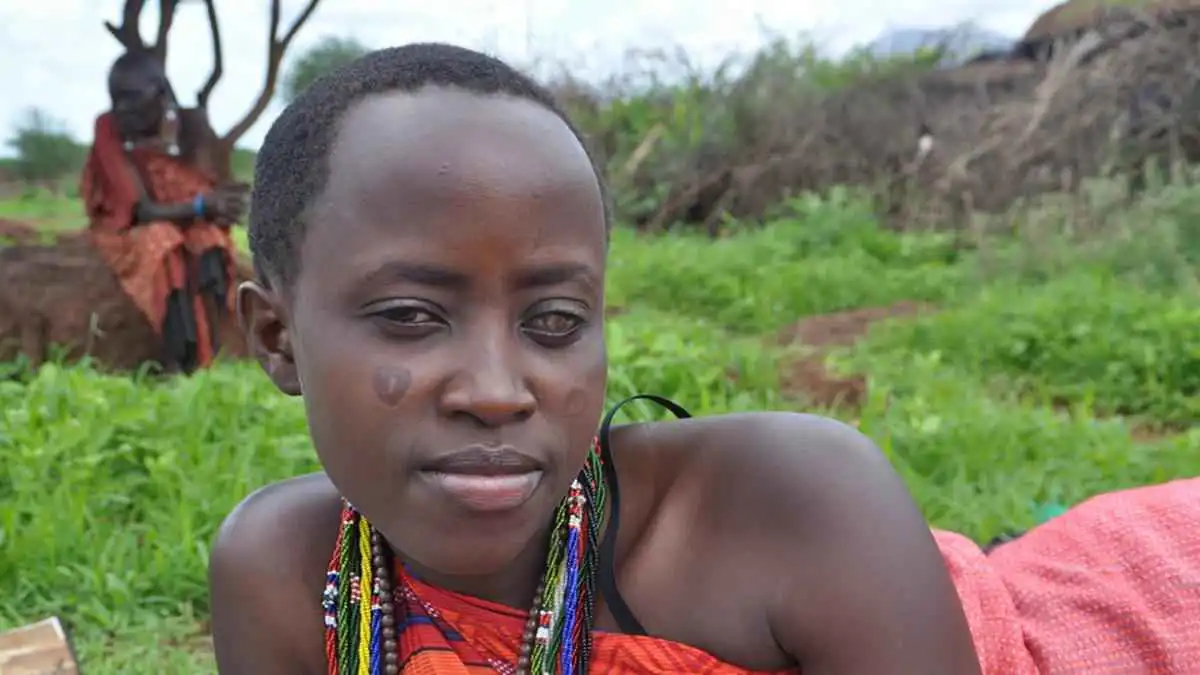 "العمى النهري".. مرض خطير يواصل الانتشار في اليمن وأفريقيا