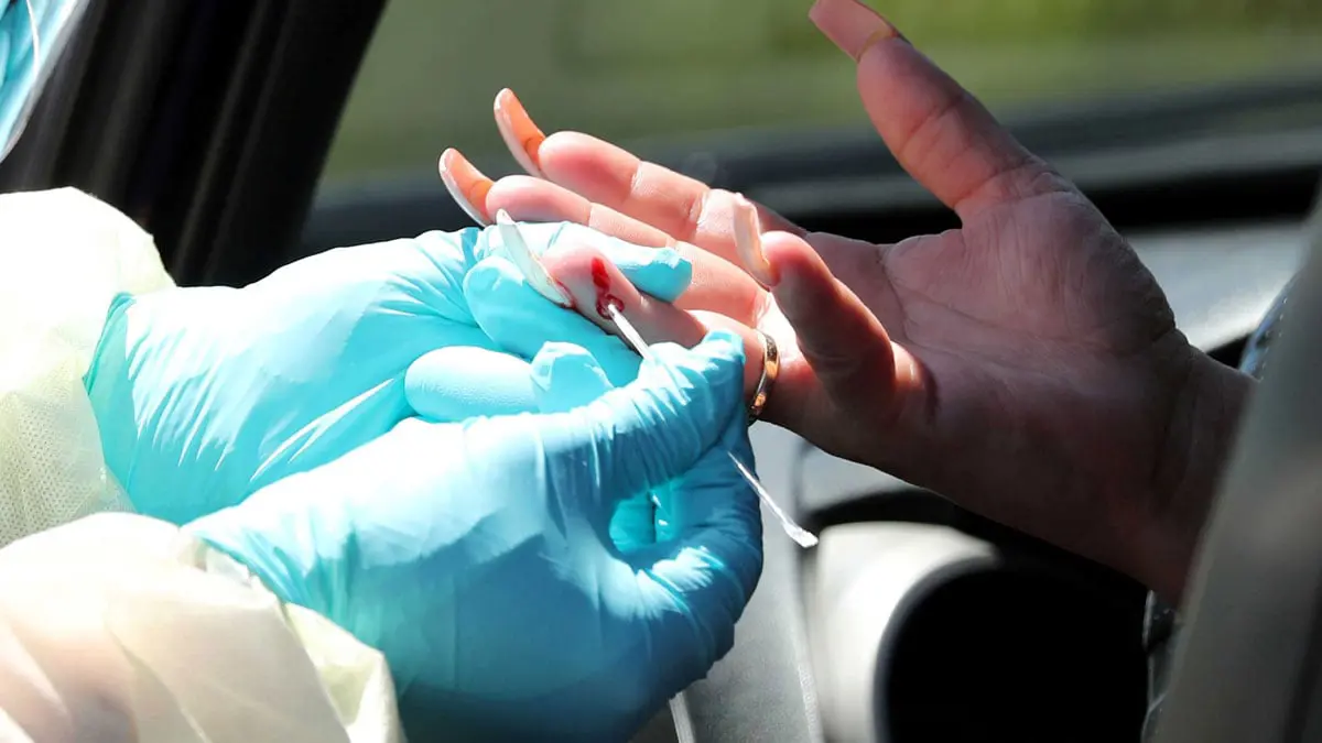 دراسة: فيروس كورونا يحفز الإصابة بالسكري عند الأصحاء