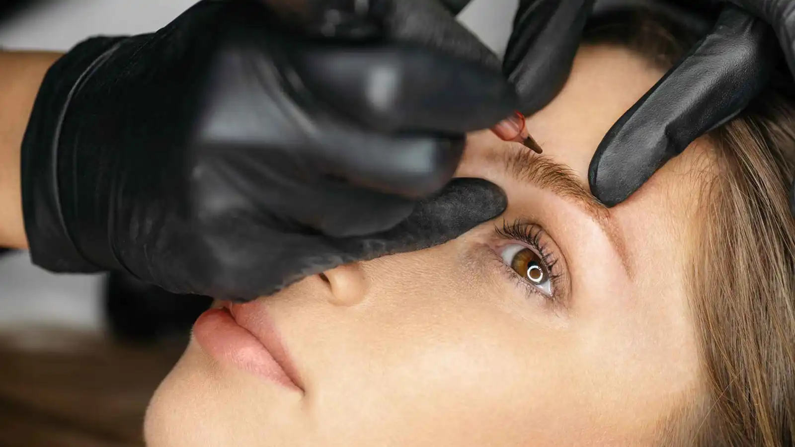 قصة امرأة أصيبت بمرض نادر وخطير بسبب تقنية تجميل شهيرة