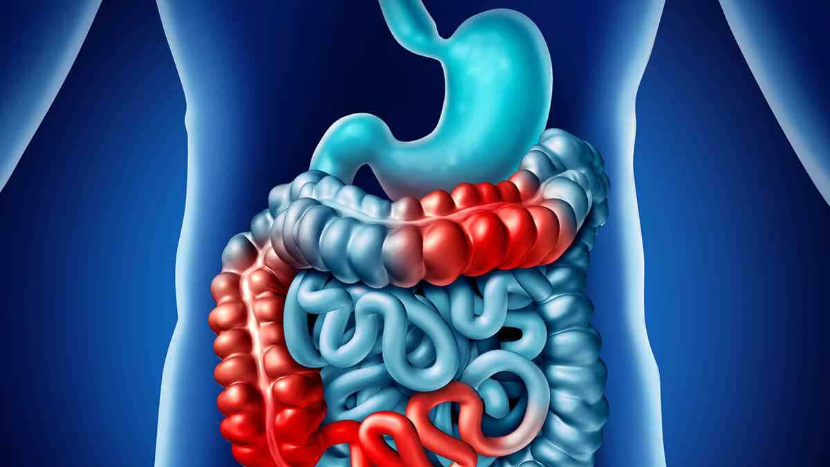 دون تنظير.. كبسولات تكشف أمراض الأمعاء في دقائق