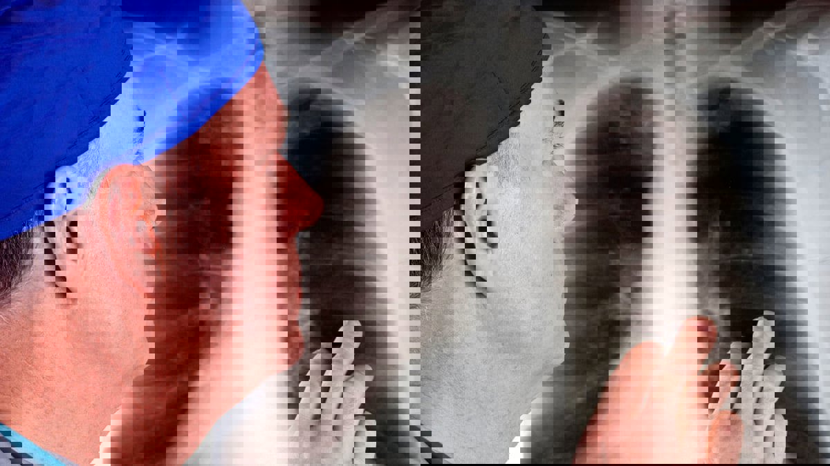 ابتكار طبي جديد يحدث نقلة في علاج سرطان الرئة