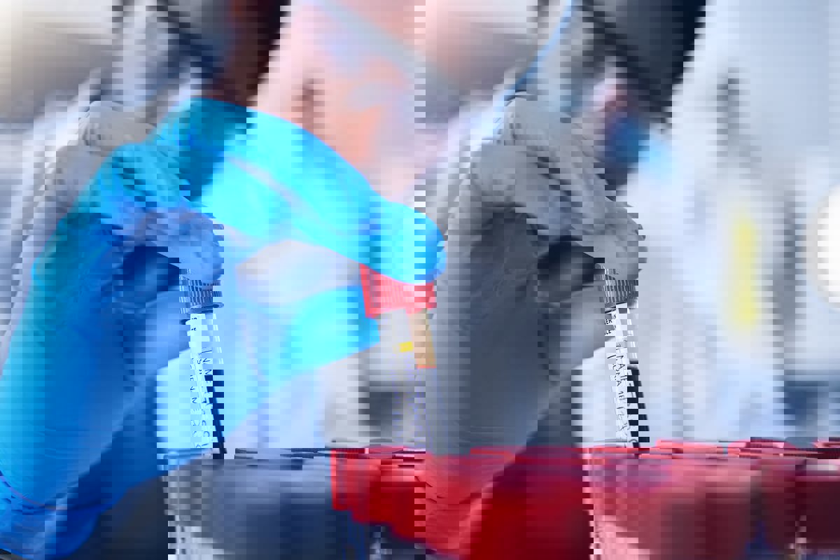 اختبار دم بسيط يتنبأ بمرض باركنسون قبل 7 سنوات من الأعراض