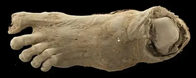 مومياء رجل بشرية