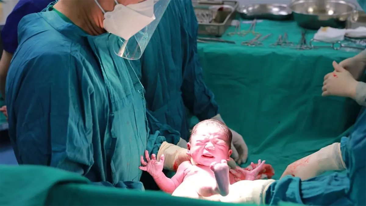 دراسة: الولادة القيصرية مرتبطة بزيادة خطر إصابة المواليد بسرطان الدم