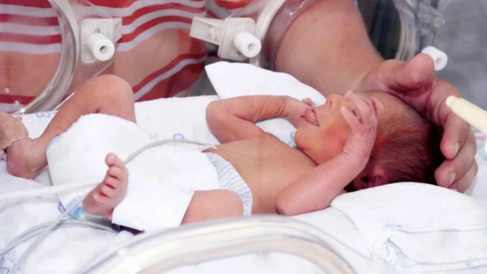 "اليرقان الوليدي".. متى يصبح خطيرا على الرضّع؟