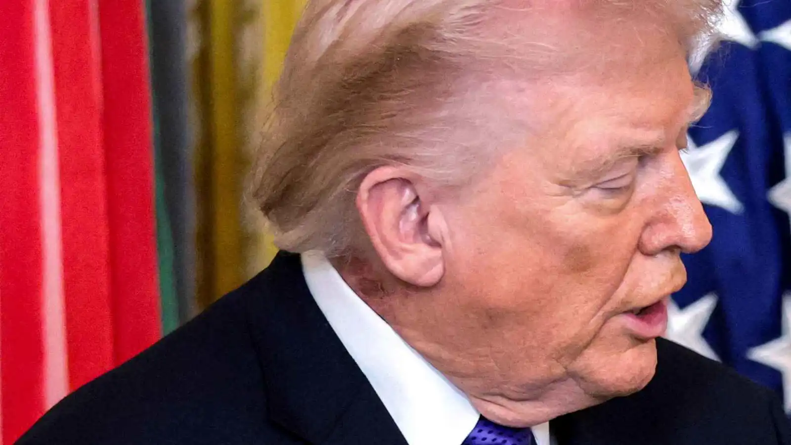 طبيب يكشف إصابة الرئيس الأمريكي ترامب بطفح جلدي على الرقبة