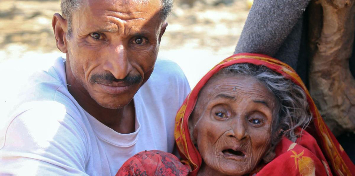 تحذير أممي: اليمن على شفا مجاعة لم يشهد العالم مثيلًا لها منذ عقود