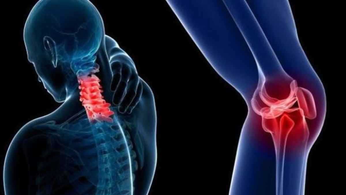 باحثون يطورون طريقة جديدة للكشف عن هشاشة العظام