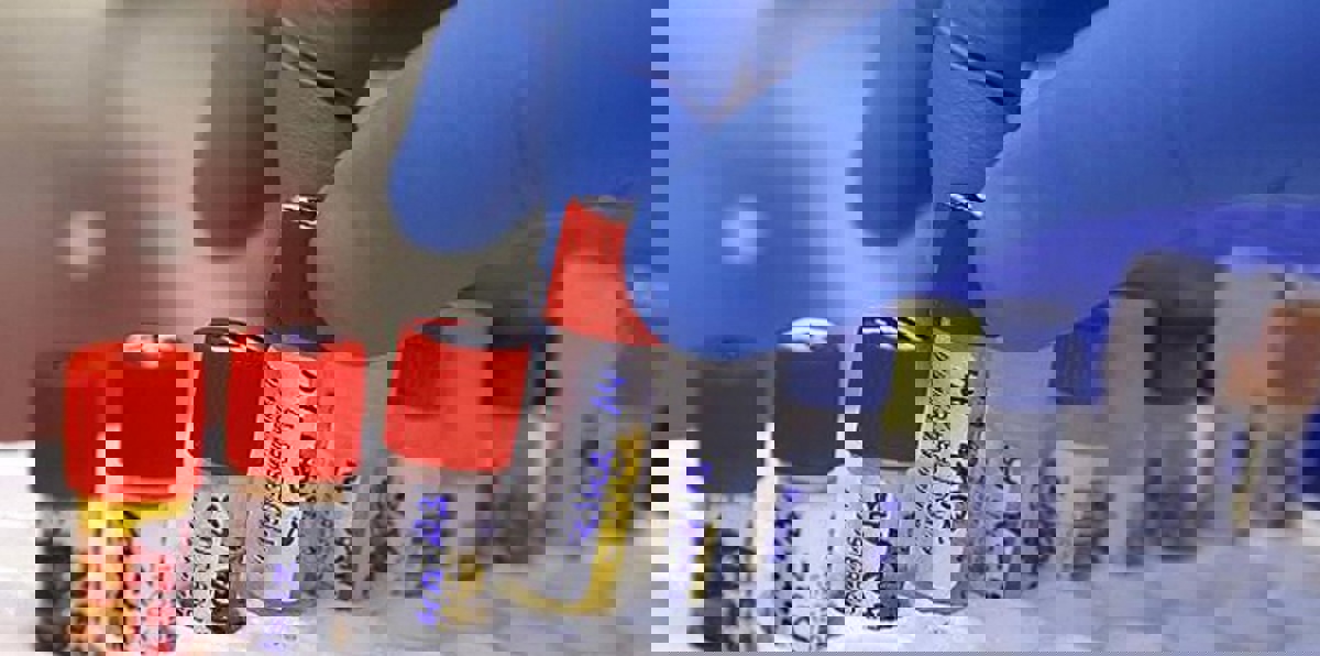 أمريكا تبدأ تجربة لقاح مضاد لفيروس زيكا