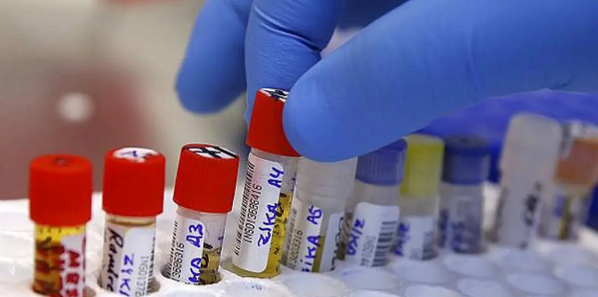 أمريكا تبدأ تجربة لقاح مضاد لفيروس زيكا