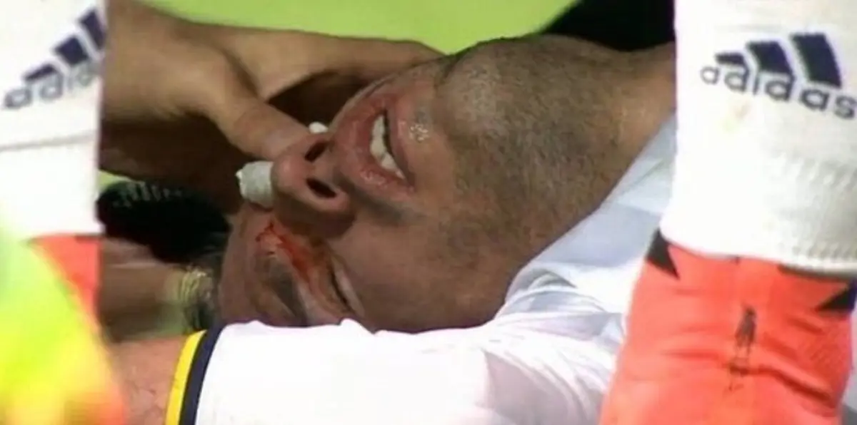 طبيب فنربخشة يوضح آخر تفاصيل إصابة فان بيرسي الخطيرة (فيديو)