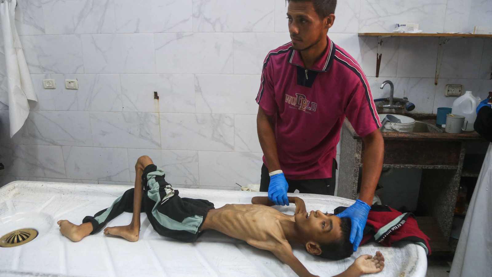 الجيش الإسرائيلي: صور مجاعة غزة "مزيفة"