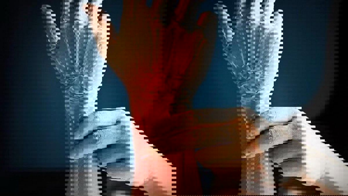 ما أفضل الأطعمة لصحة العظام؟