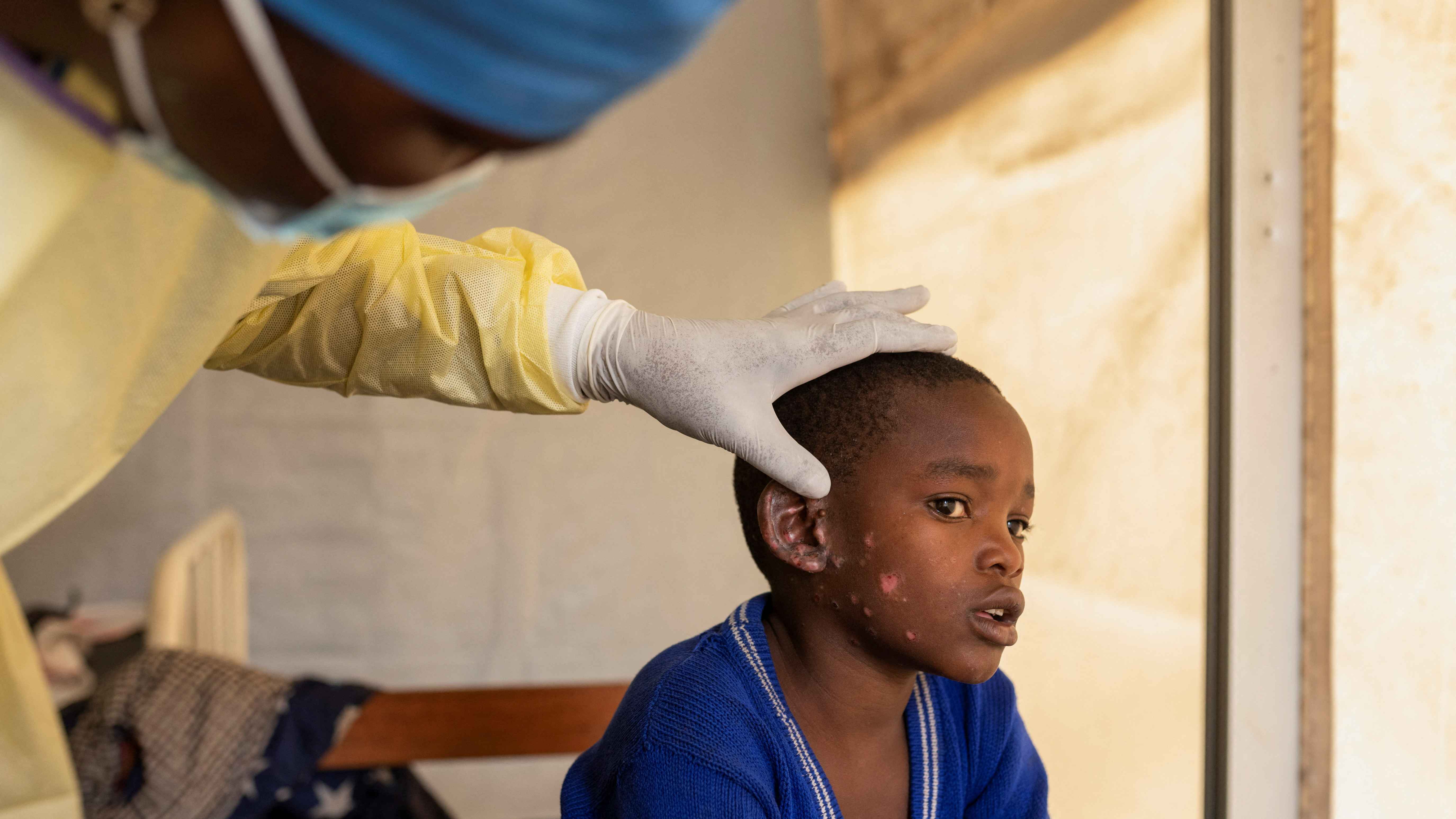 وفاة 6 أطفال جراء تسممهم بمبيد حشري في جنوب أفريقيا