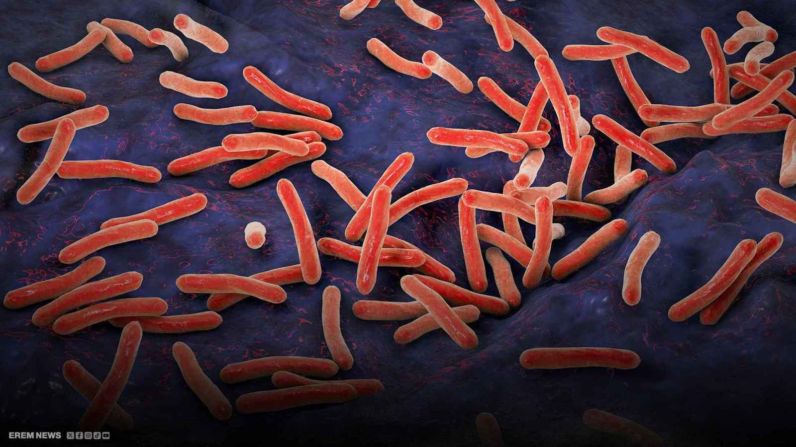 بكتيريا السل تحت المجهر.. آلية خفية تكشف مفتاح العلاج (فيديو إرم)