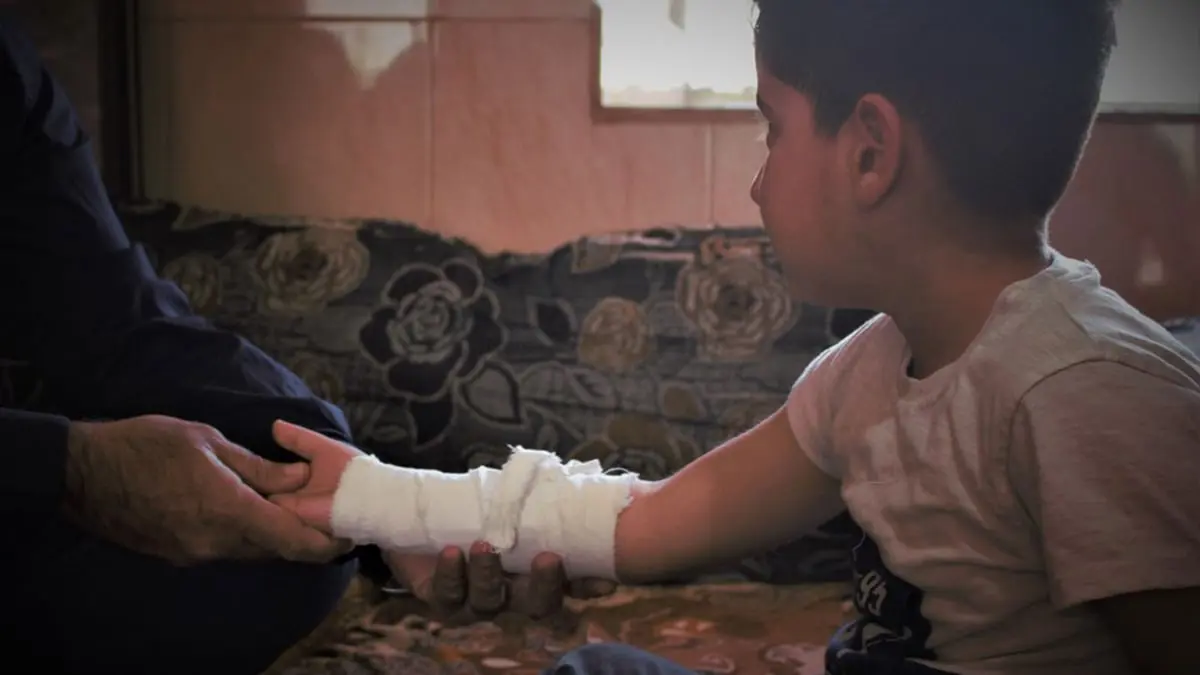 "المجبّر العربي".. مهنة متوارثة تزدهر في شمال شرق سوريا