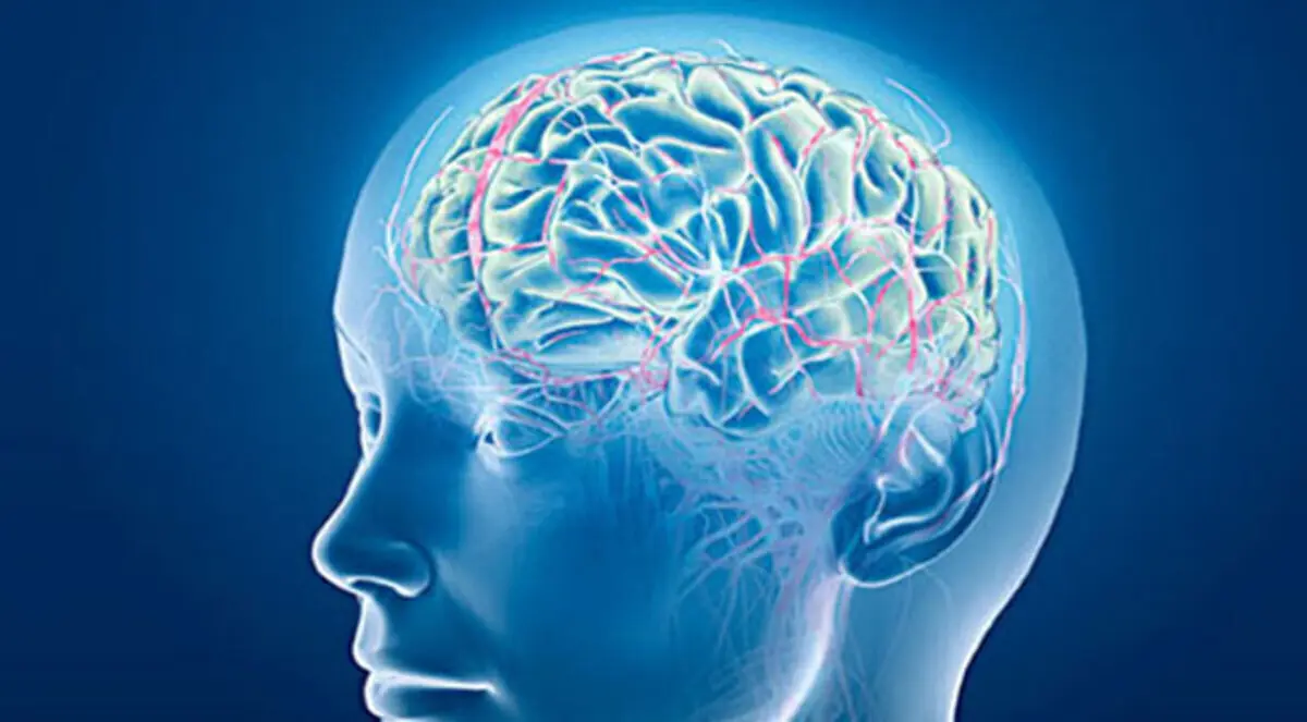 تنشيط المخ يساعد على التعافي من السكتة الدماغية