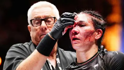 إيرين ألداما