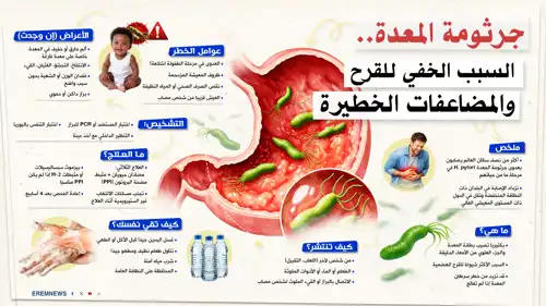 جرثومة المعدة