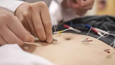 علاج السمنة بالإبر المكهربة