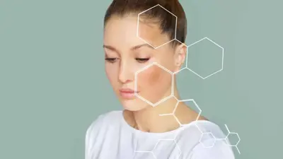 قناع الحمل (تعبيرية)