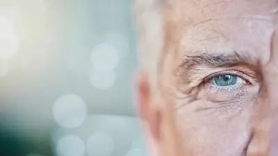 تجعد الجفون (تعبيرية)