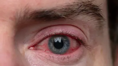 العين الوردية