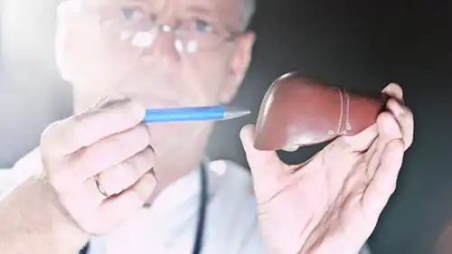 شفاء الكبد الدهني (تعبيرية)