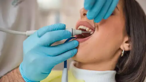 صحة الفم (تعبيرية)