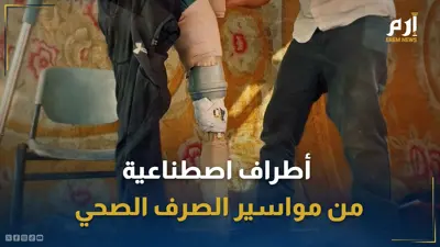 مصاب غزاوي يرتدي طرفا اصطناعيا