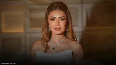 عملية تجميل مفاجئة.. فنانة مصرية تثير الجدل بتغيير ملامحها