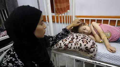 طفلة تعاني من نقص الغذاء في غزة